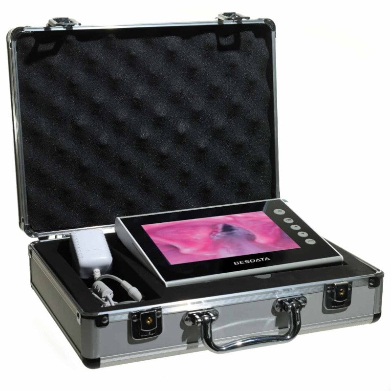 Bronchoscopy Monitor