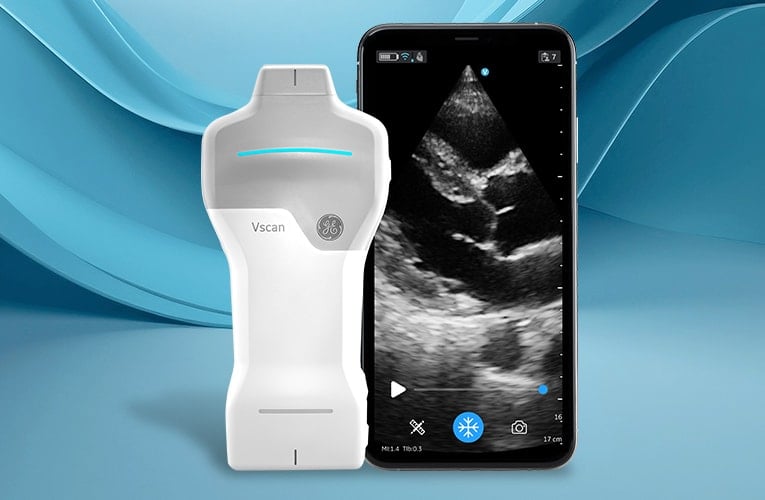 Vscan Air™ SL Ultrasound System