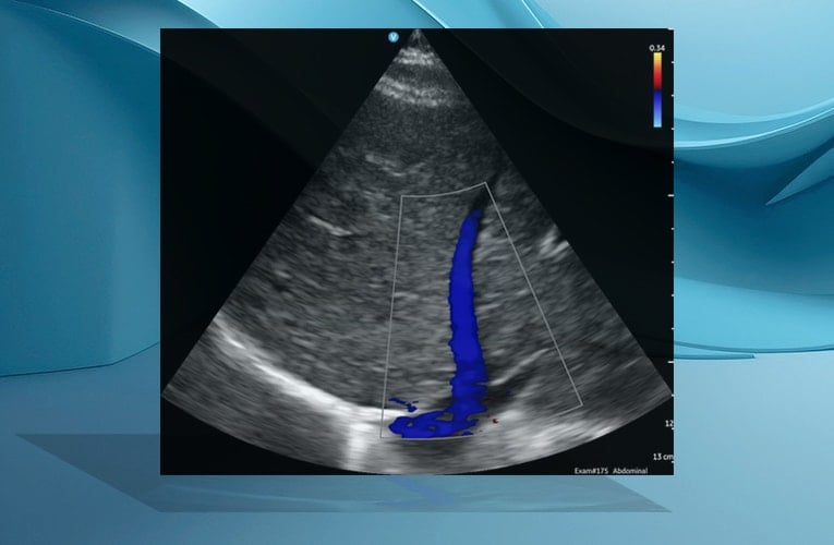 Vscan Air™ SL Ultrasound System