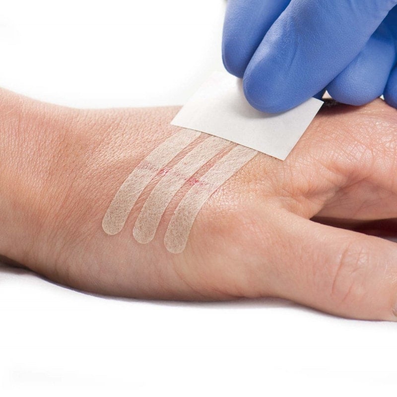 Omnistrip Wound Closure Strips 6 x 38 mm (50 x 6 pieces)