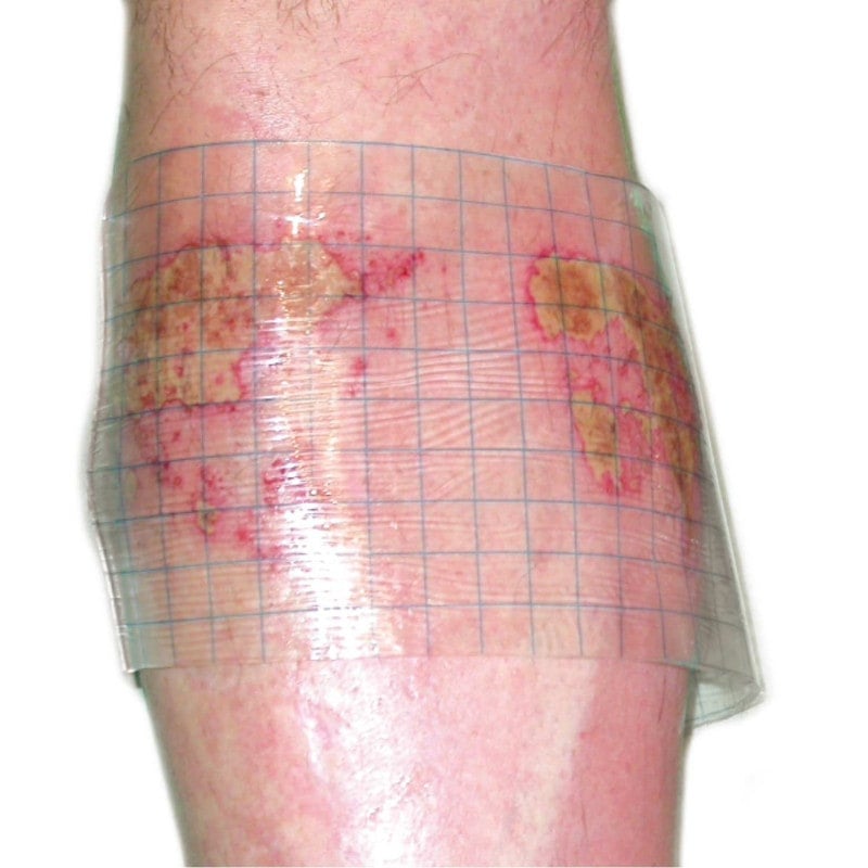 HydroTac transparent Gel Dressing 10 cm x 10 cm