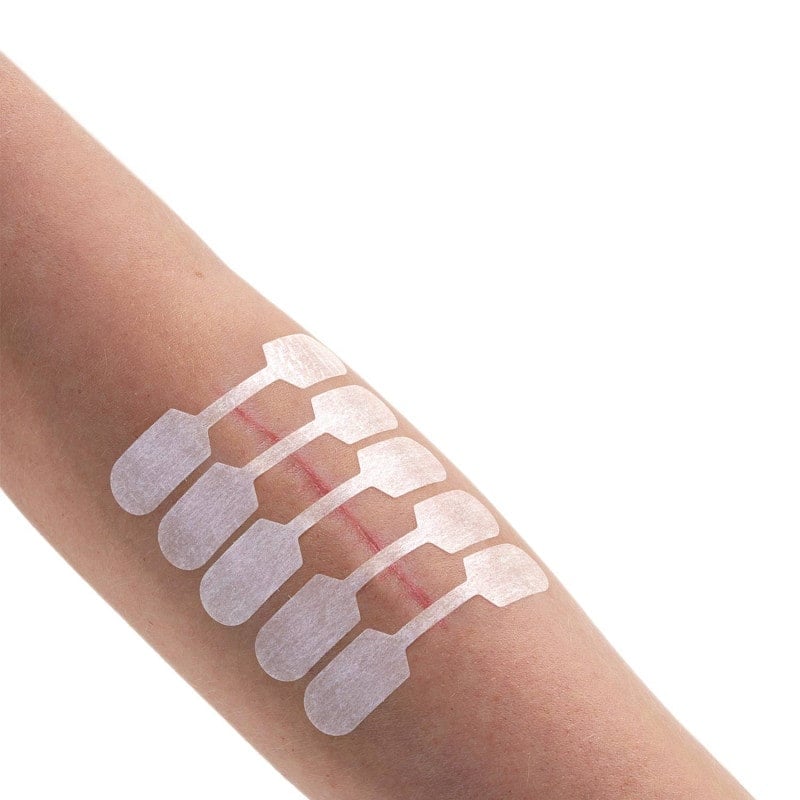 Sterigrap Wound Closure Strips Dumbbell, 32 x 8 mm (10 PCS)