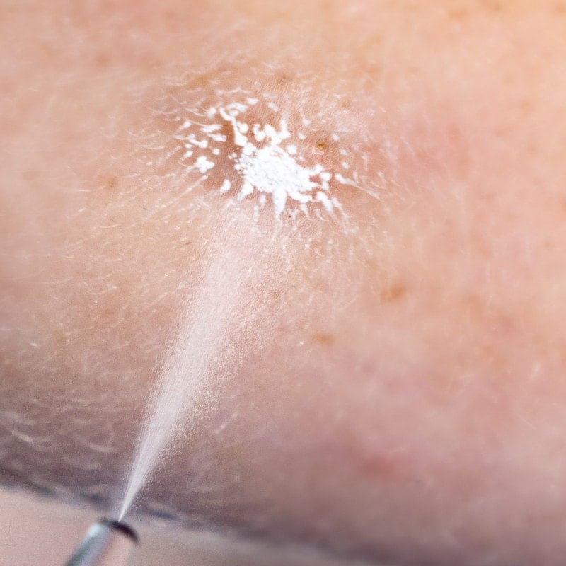 Cryoalfa SUPER Contact | in blister