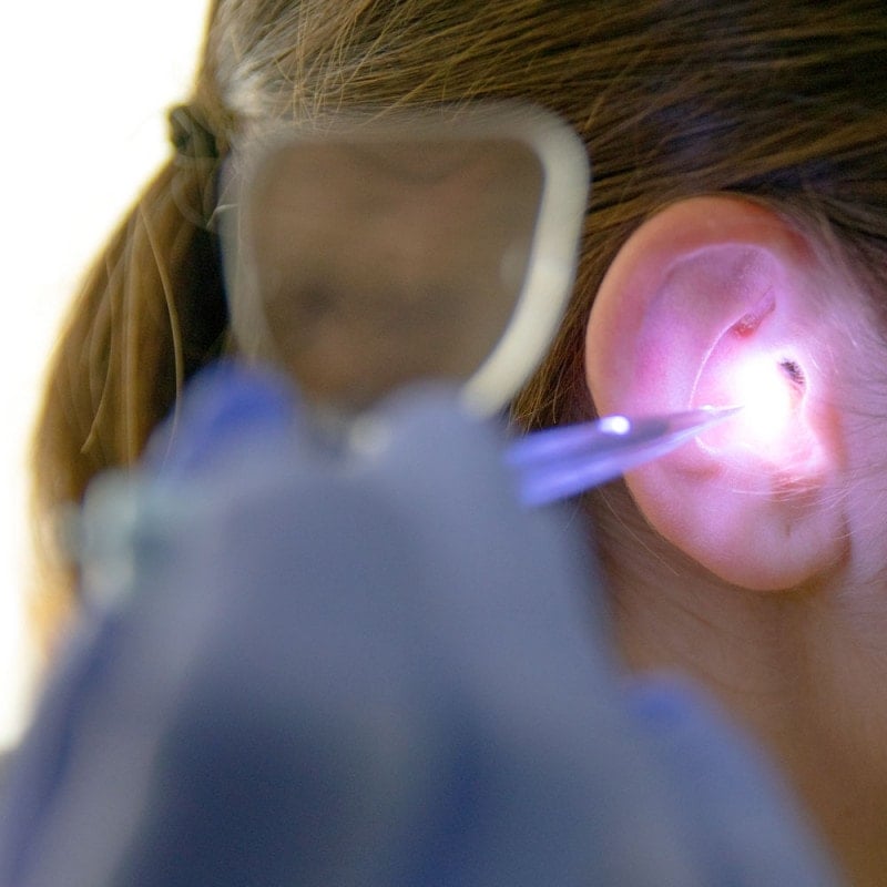 Bionix Illuminating Ear Curettes