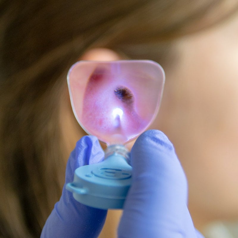 Bionix Illuminating Ear Curettes