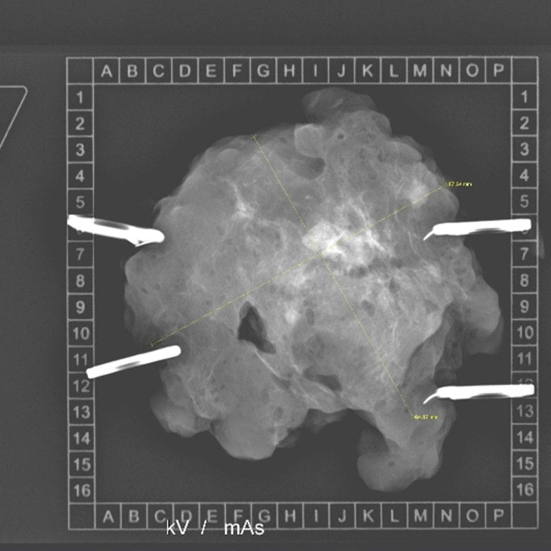 KLINITRAY™ Mammary Plates R | Small