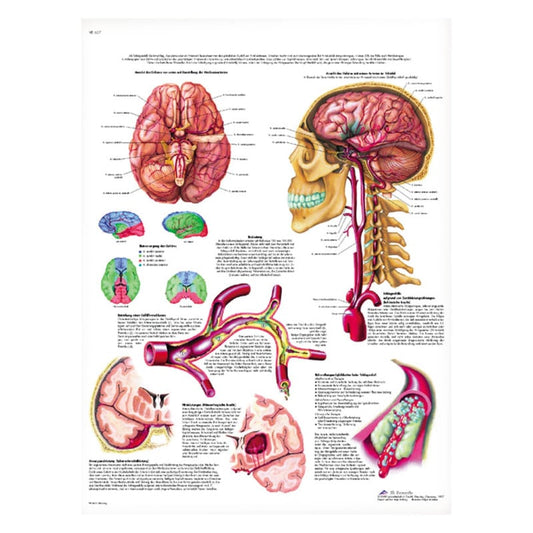 Stroke Wall Chart German