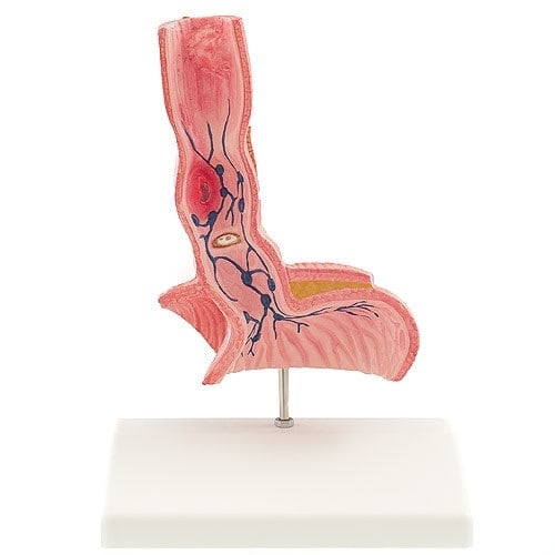 Oesophagus Model