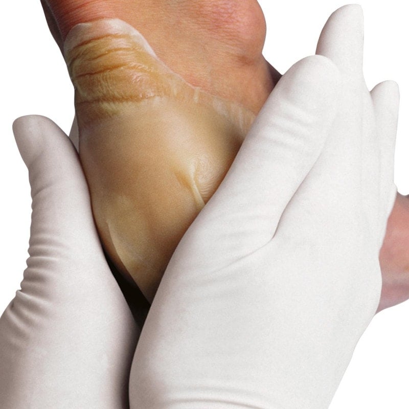Hydrocoll Hydrocolloid Dressing 10 x 10cm