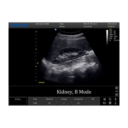 CHISON ECO5 Ultrasound Machine with Color Doppler + linear transducer