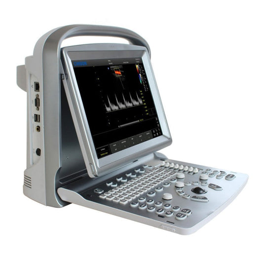 CHISON ECO5 Ultrasound Machine with Color Doppler + linear transducer