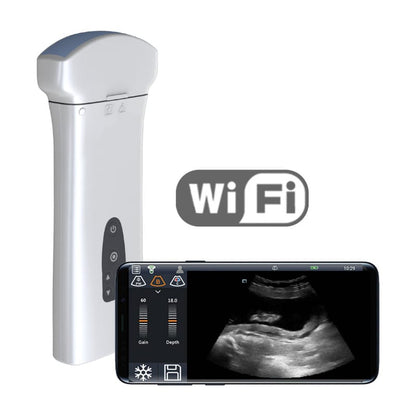 Youkey D8 Mobile Ultrasound Machine color | with micro-convex transducer (C8-5Ks)