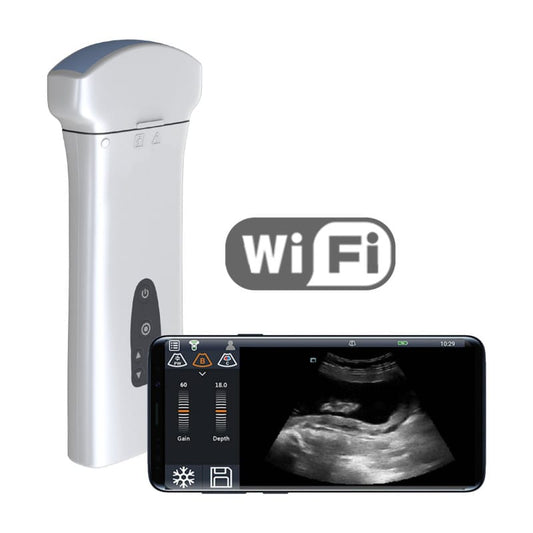Youkey D8 Mobile Ultrasound Machine color | with linear transducer (L11-4Ks)