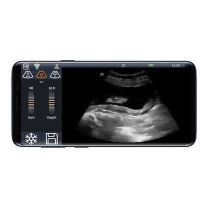 Youkey D8 Mobile Ultrasound Machine color | with micro-convex transducer (C8-5Ks)