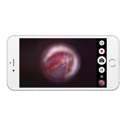 Firefly DE570 W-LAN HD Digital Otoscope