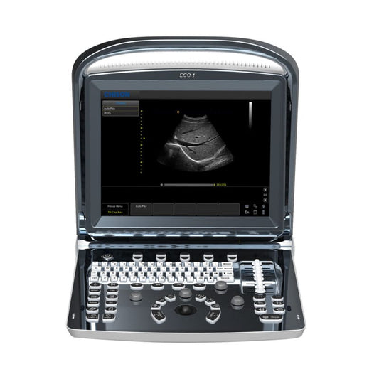Chison ECO 1 Ultrasound Machine without rechargeable battery | convex transducer (C3-A)