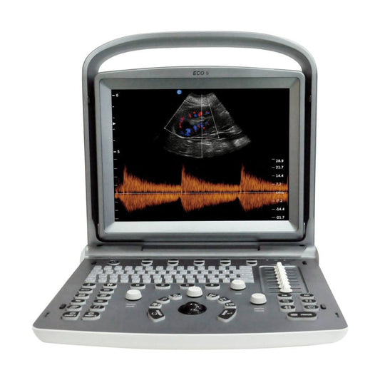 Chison ECO 6 Ultrasound Machine with C3-A convex transducer