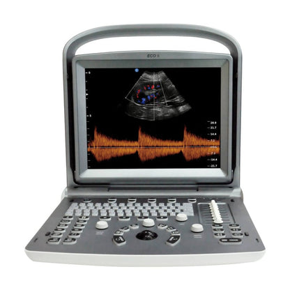 Chison ECO 6 Ultrasound Machine with C3-A convex transducer & P3-A phased array transducer