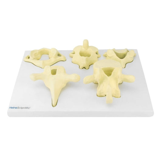 Model of Vertebrae Types