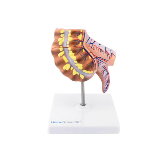 Appendix Model
