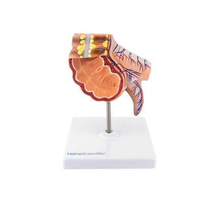 Appendix Model