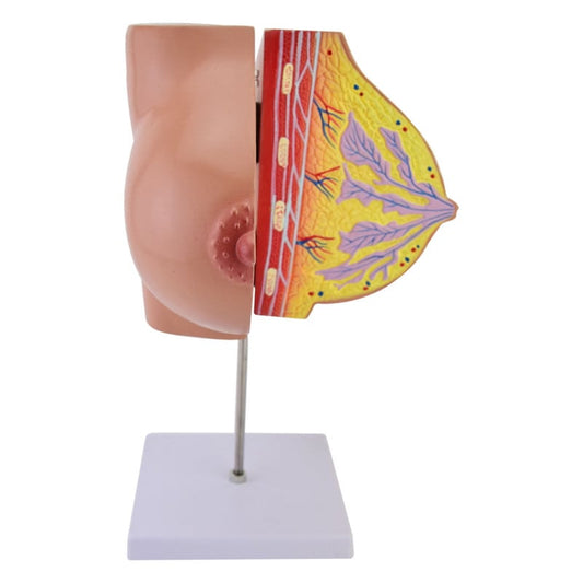 Breast Model