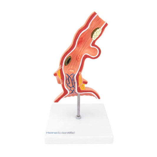 Oesophagus Model with Diseases