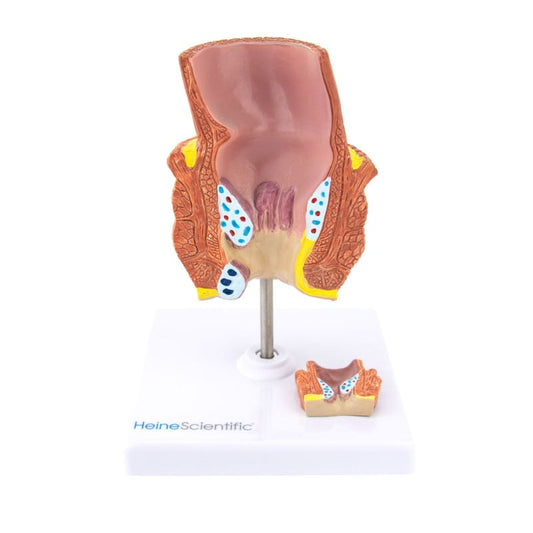Haemorrhoid Model