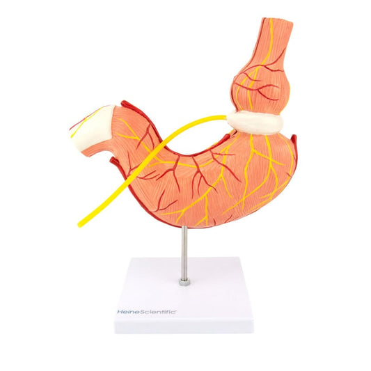 Stomach Model with Gastric Band