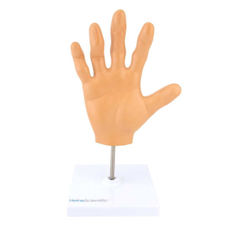 Hand Model with Rheumatoid Arthritis