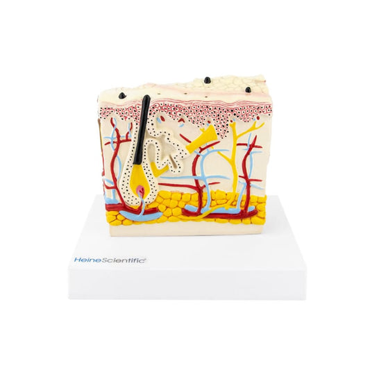 Model Skin with Psoriasis