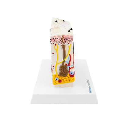 Model Skin with Psoriasis