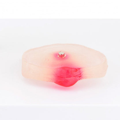 Herniated Disc Model