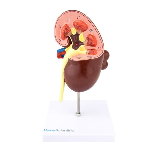 Kidney Model with Diseases