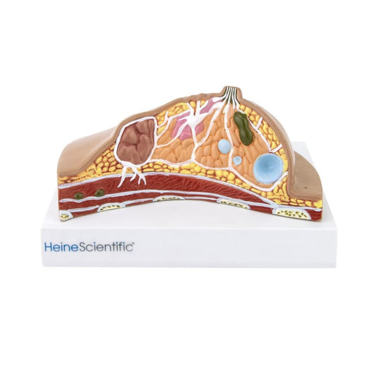 Female Breast Model with Diseases