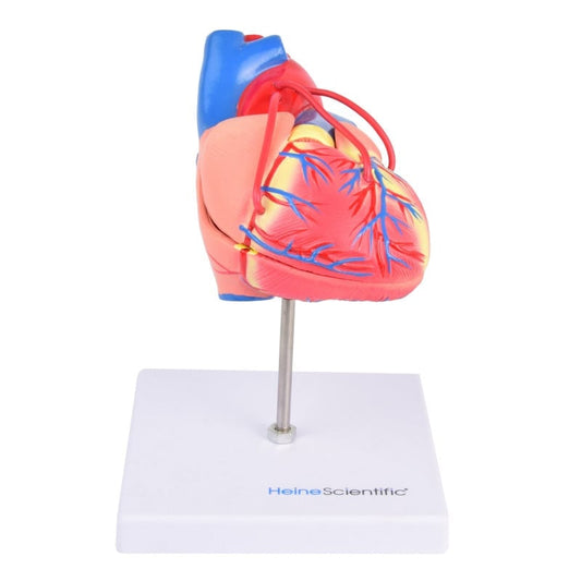 Heart Model with Bypass
