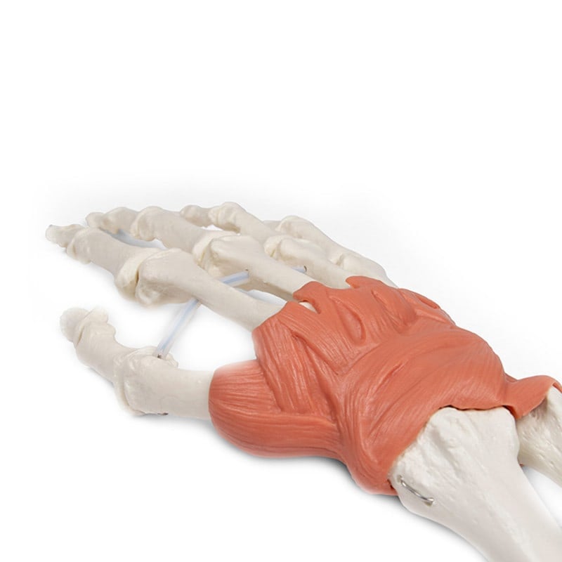 Wrist Ligaments