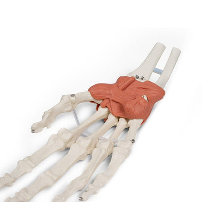 Wrist Ligaments