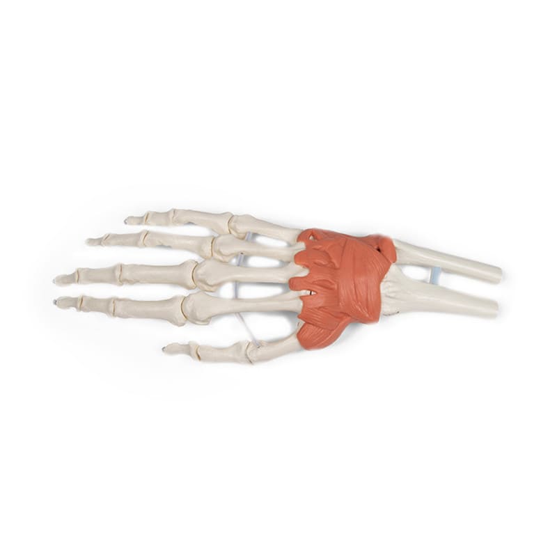 Wrist Ligaments