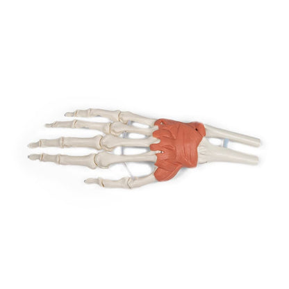 Wrist Ligaments