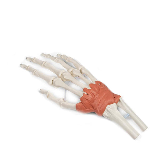Wrist Ligaments