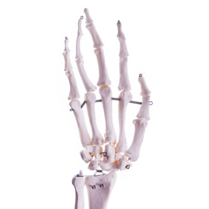 Arm Skeleton