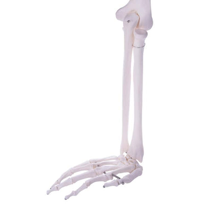 Arm Skeleton