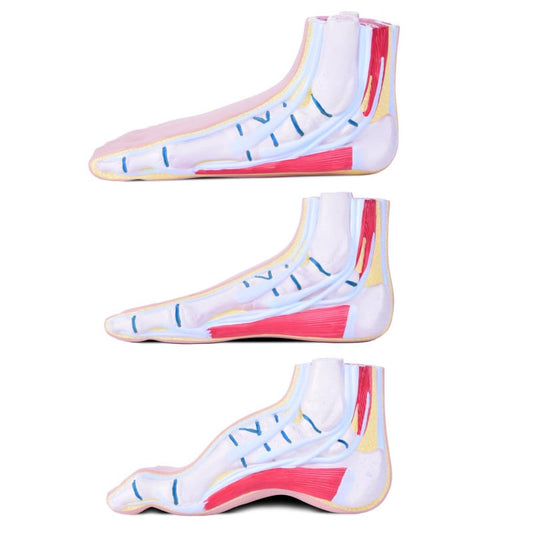 Model of Foot Malpositions