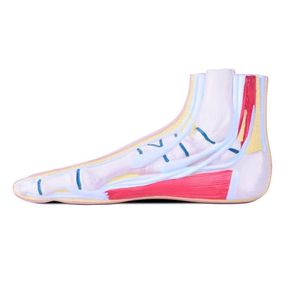 Model of Foot Malpositions