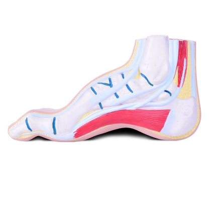 Model of Foot Malpositions