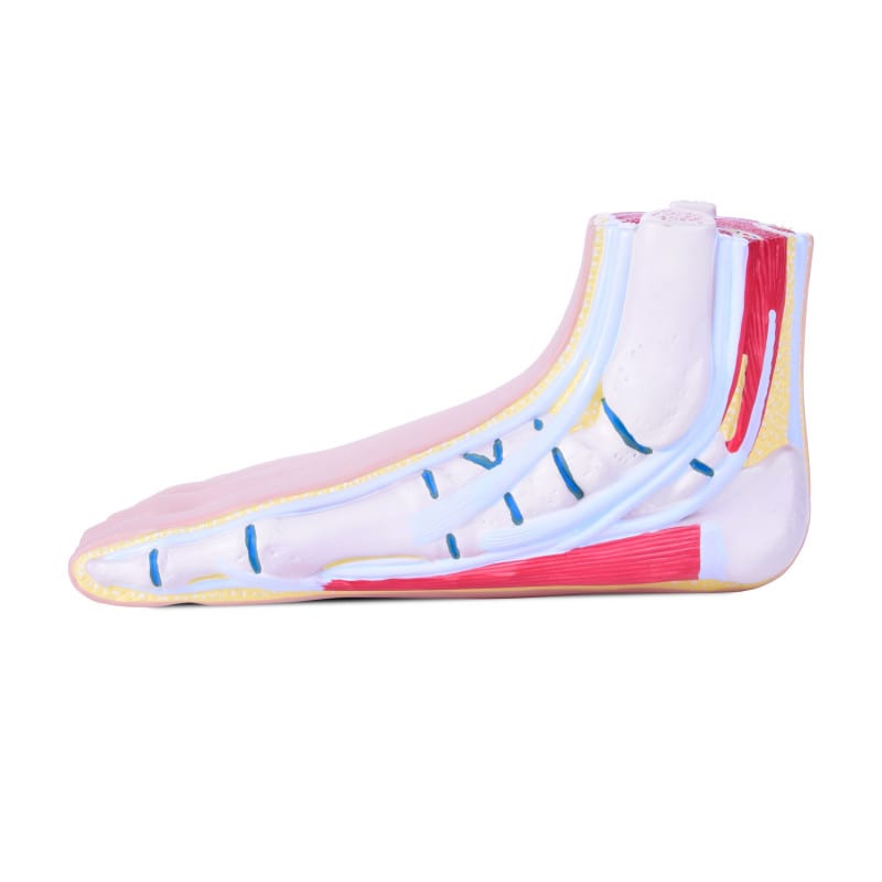 Model of Foot Malpositions