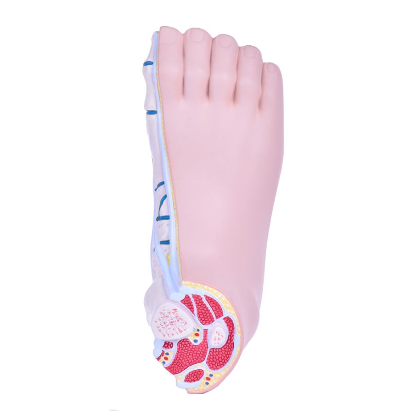 Model of Foot Malpositions