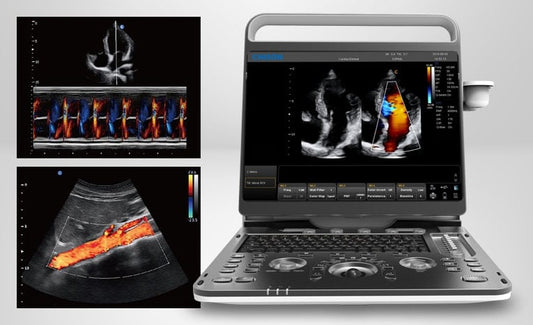 Chison EBit 60 Ultrasound System incl. ultrasound trolley (with height adjustment)