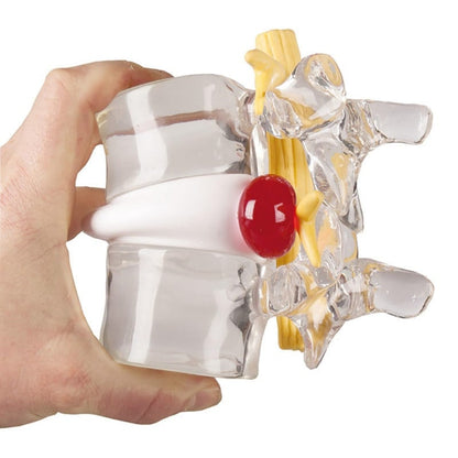 Herniated Disc Simulator